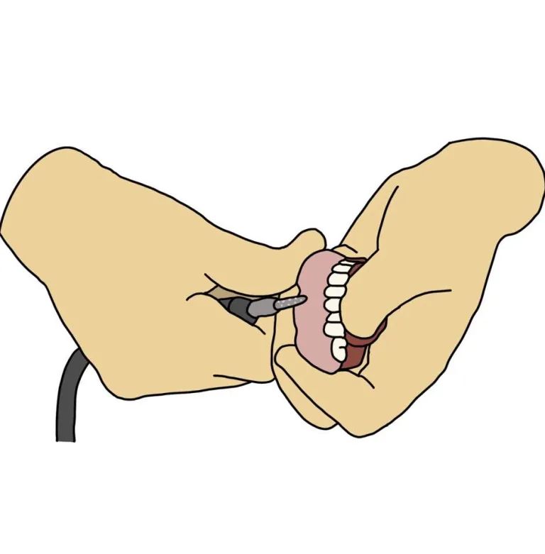 Illustration of a denture repair in progress